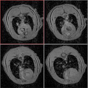MRI slices of beating rat heart.