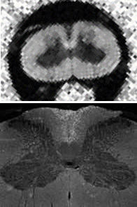 Diffusion anisotropy map of ex vivo rat spinal cord (top) compared to myelin basic protein histology (bottom).